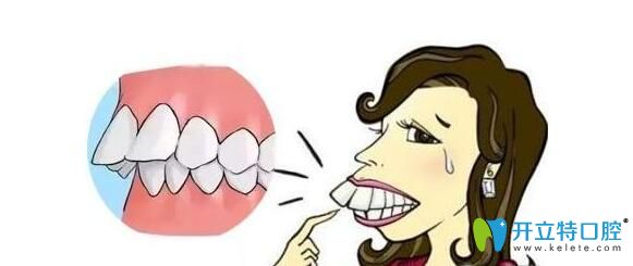 做過掩飾性正畸可以正頜嗎？真人經(jīng)驗(yàn)分享