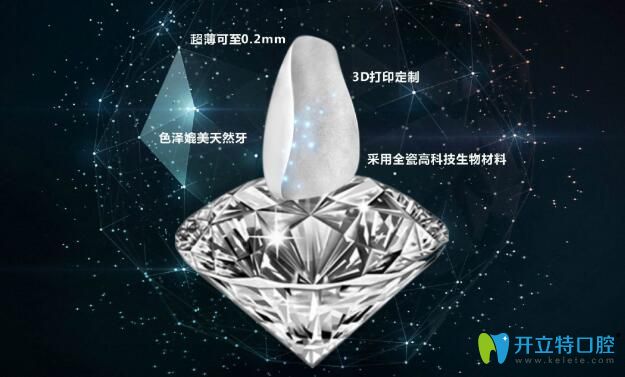 牙齒美白貼面新寵：納米冰瓷牙貼面有弊端嗎？