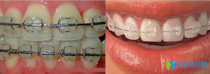 陶瓷自鎖和非自鎖的圖片