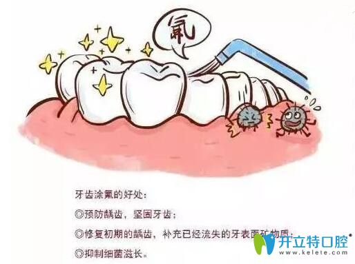 泉州維樂(lè)口腔董龍福醫(yī)生介紹兒童牙齒涂氟