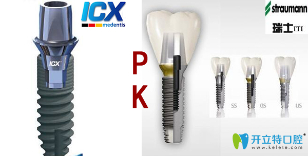 德國(guó)icx和瑞士iti種植體PK看哪個(gè)好