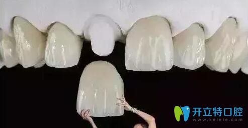 解答：做了全瓷牙基牙爛掉的概率高嗎？