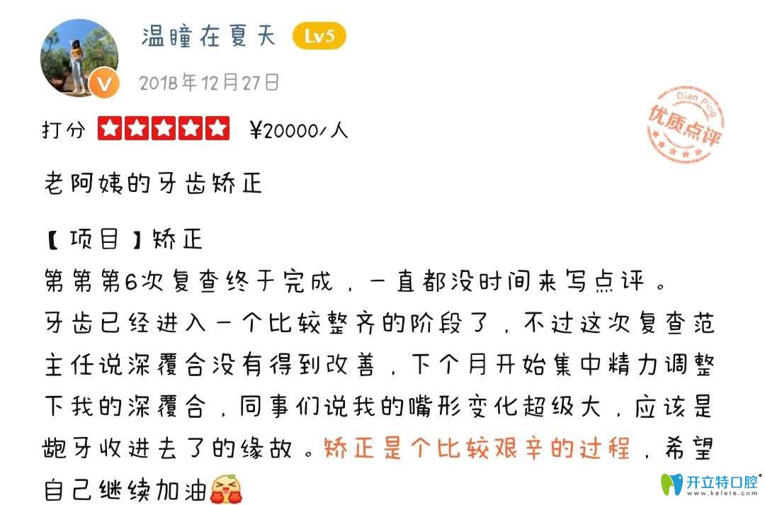 顧客正在成都圣貝口腔正畸中，表示變化挺大的