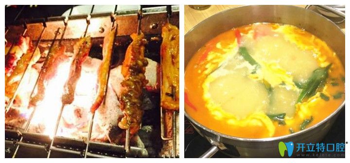 做牙齒矯正期間必須抵擋各種美食誘惑