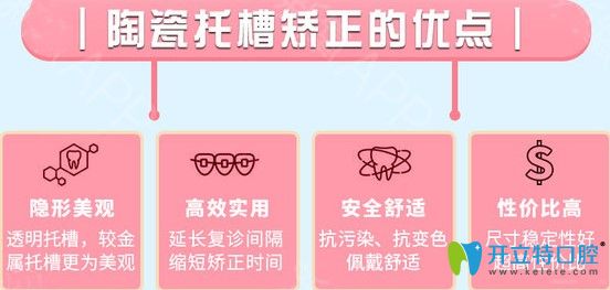牙博士陶瓷托槽矯正優(yōu)點(diǎn)