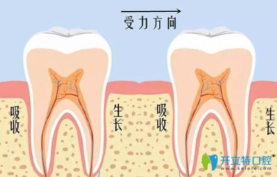 維樂口腔李書琴醫(yī)生告訴你：牙齒矯正會(huì)導(dǎo)致牙齒松動(dòng)嗎