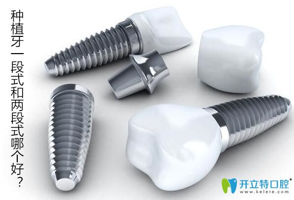 種植牙一段式和兩段式哪個好，不同種植體的區(qū)別在哪？