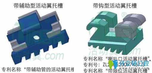 活動翼矯治器兩種類型