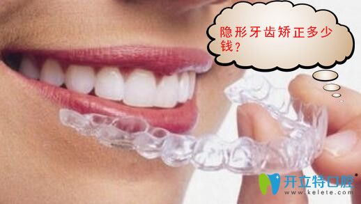 隱形矯正牙齒多少錢?時(shí)代天使價(jià)格17000元矯正效果好嗎？