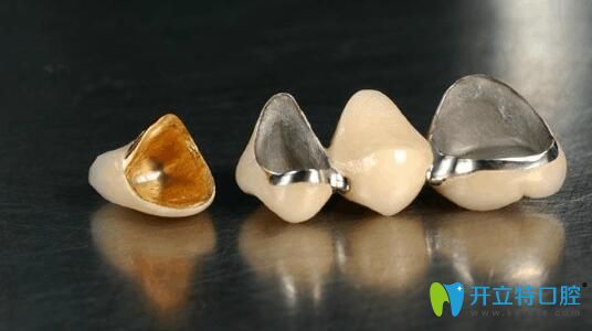 曹振醫(yī)生告訴大家：烤瓷牙有哪些種類和價格各是多少