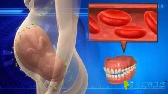 孕期牙疼需要及時(shí)到醫(yī)院看診