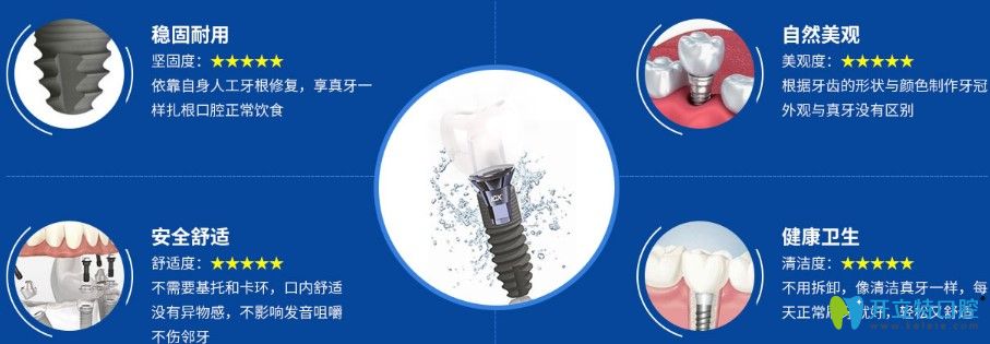 歐美種植牙優(yōu)勢圖 歐美種植牙優(yōu)勢圖