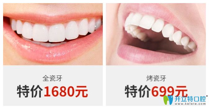 正夫口腔全瓷牙和烤瓷牙價格圖示 正夫口腔全瓷牙和烤瓷牙價格圖示