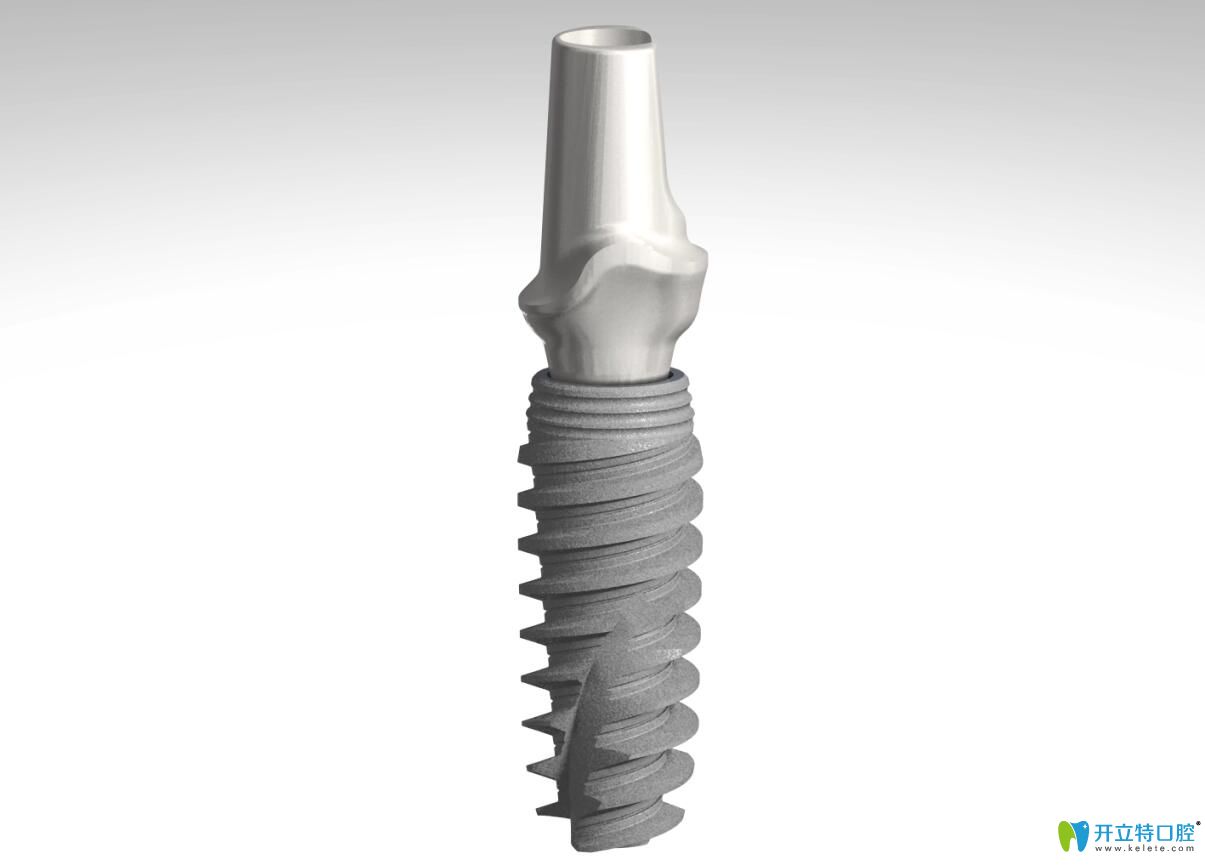 諾貝爾Active種植體