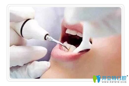 藝星口腔王黨紅說(shuō)出現(xiàn)黑三角應(yīng)該如何應(yīng)對(duì)