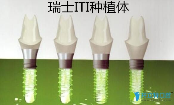 告訴你如何辨別瑞士iti種植體的真假,讓你做種植牙不上當(dāng)