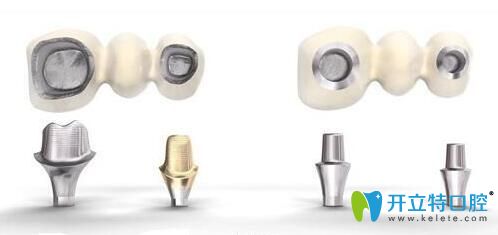 種植牙純鈦基臺