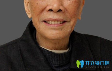 做了全口種植牙的老爸看上去年輕了十歲不止