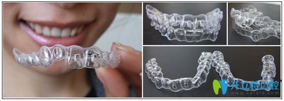 北京瑞鯊口腔張嘉熙醫(yī)生介紹時(shí)代天使雙模和單模的區(qū)別 北京瑞鯊口腔張嘉熙醫(yī)生介紹時(shí)代天使雙模和單模的區(qū)別