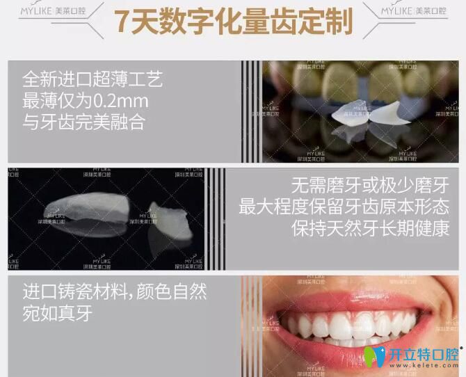 深圳美萊口腔隱形臻薄牙貼面的優(yōu)勢(shì)