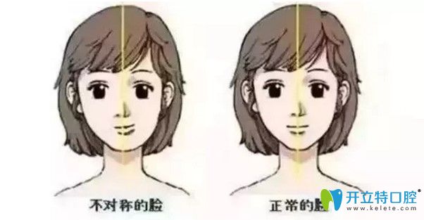 王迪醫(yī)生告訴大家：長期用單側(cè)牙齒咀嚼食物可能造成大小臉