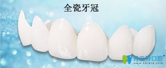 全瓷牙冠展示圖 全瓷牙冠展示圖