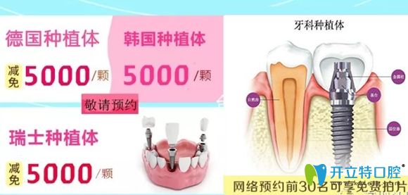 美佳德口腔做種植牙網(wǎng)絡(luò)預(yù)約前30名可享免費拍片