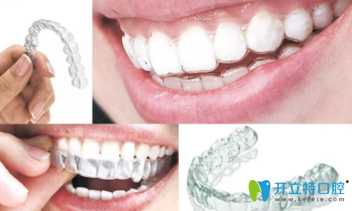 正雅和美立刻哪個(gè)好