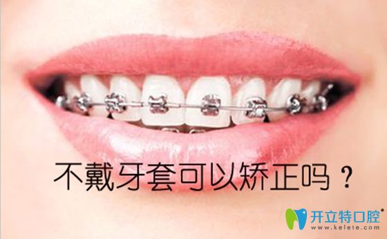 想整牙但不想帶牙套,請(qǐng)看不戴牙套矯正牙齒的方法