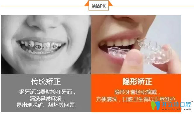 時代天使隱形矯正優(yōu)勢