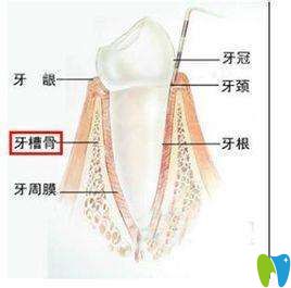 牙槽骨條件差能做種植牙嗎