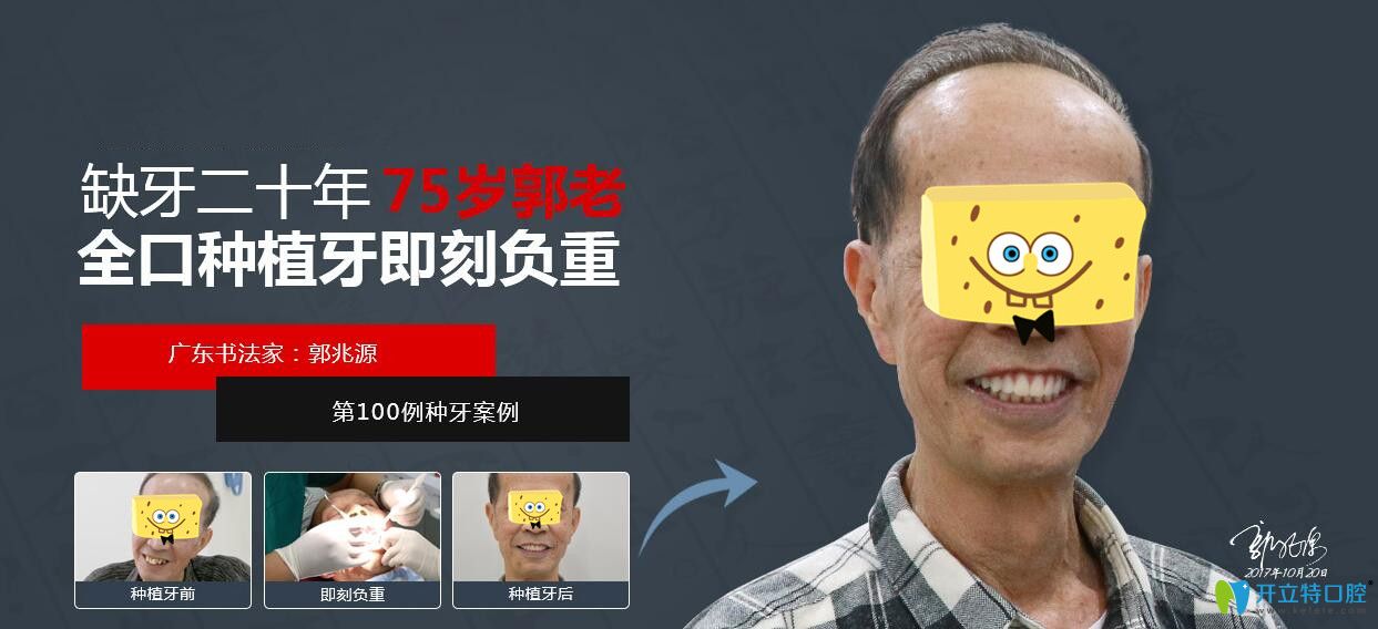 七旬老人在廣州廣大口腔做的全口種植牙