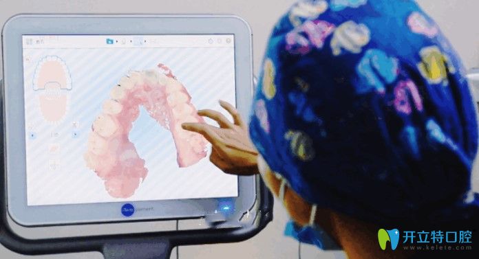 北京維樂口腔iTero口掃作用