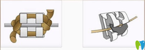 陶瓷自鎖和不自鎖的區(qū)別