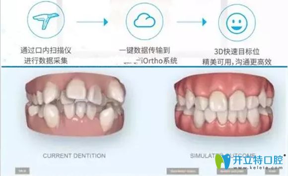 樂(lè)山英美口腔的口掃設(shè)備圖