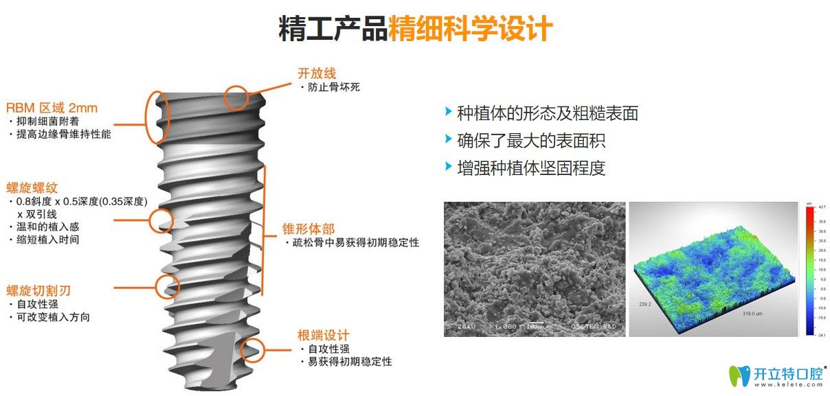 億美佳口腔韓國(guó)奧齒泰體優(yōu)勢(shì)多多