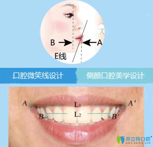 廣州美萊在正畸方面有獨到的美學(xué)標準