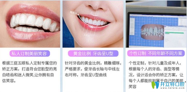 格倫菲爾口腔牙齒矯正特色之隱形矯正