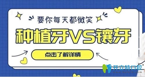 高昂醫(yī)生講解種植牙和鑲牙的優(yōu)點(diǎn)和缺點(diǎn)