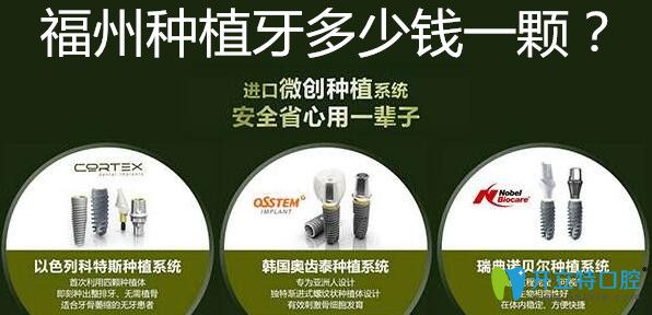 福州種植牙多少錢一顆