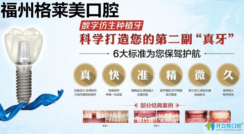 福州格萊美口腔數(shù)字仿生種植牙技術(shù)