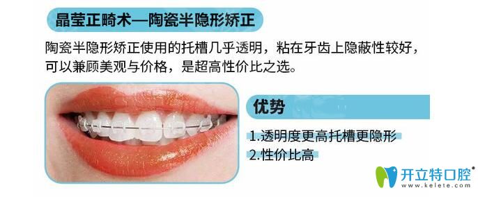 陶瓷托槽半隱形矯正優(yōu)勢