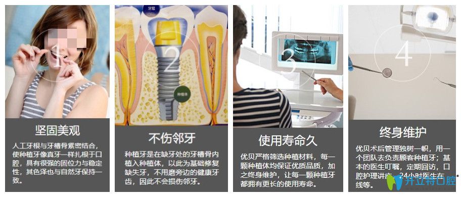 優(yōu)貝口腔種植牙的4大優(yōu)勢(shì)