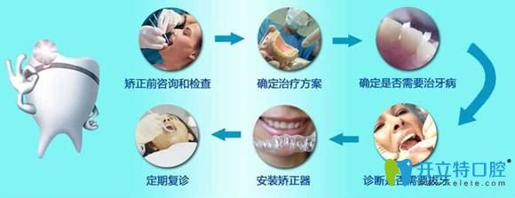 牙齒矯正過(guò)程