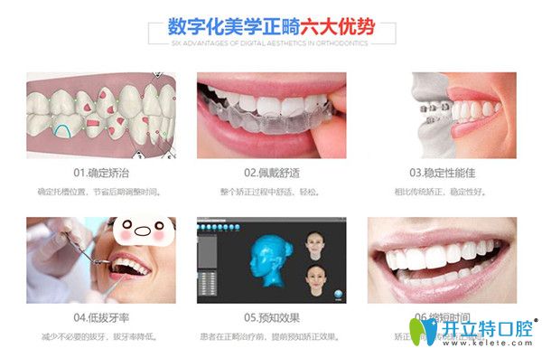 數(shù)字化美學(xué)正畸六大優(yōu)勢