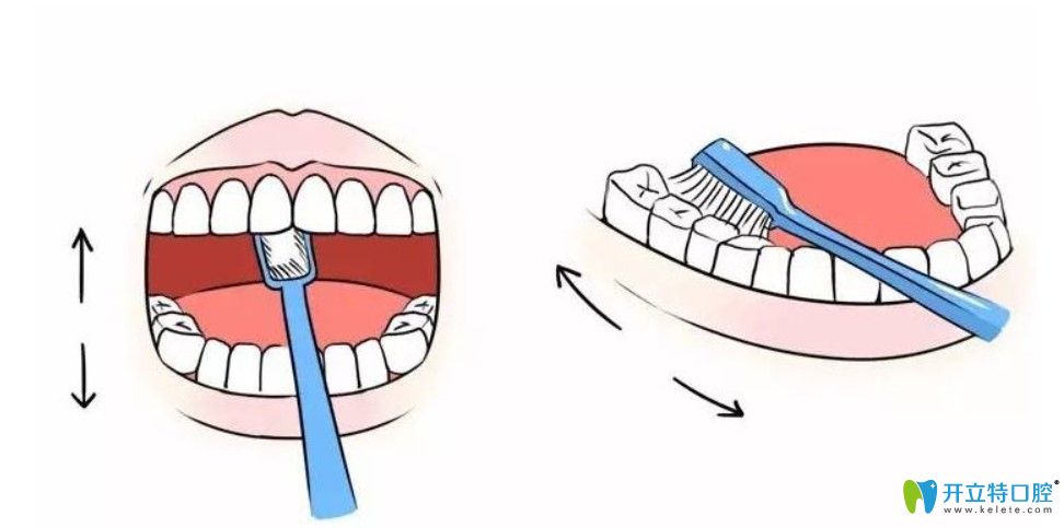 種完牙造成牙槽骨吸收的原因