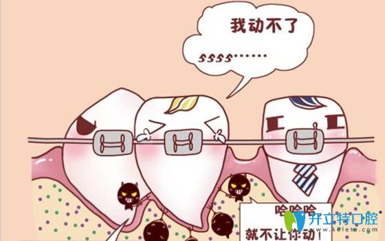 牙周病必須治療后才可以進行正畸