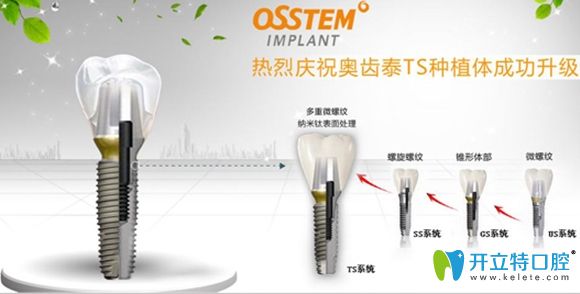 瑞士iti的效果反饋好評(píng)度要比奧齒泰略高一籌