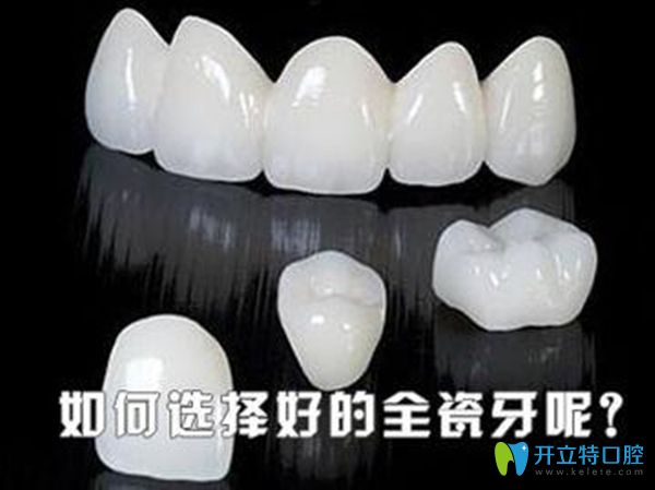 2025全瓷牙品牌排行榜及價(jià)格表-含威蘭德|愛(ài)爾創(chuàng)|澤康全瓷牙