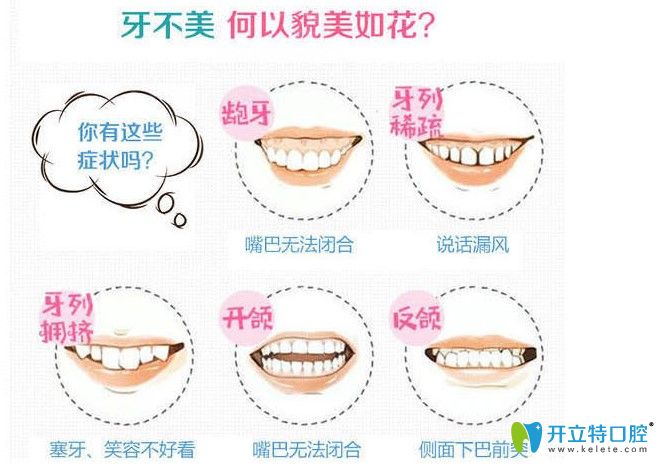 牙齒畸形趕緊趁著活動(dòng)來(lái)銘德做正畸